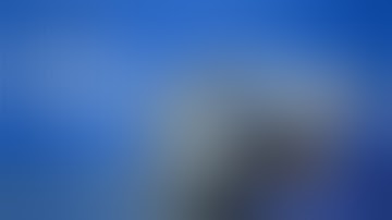 What is robotic surgery ? Difference between traditional & laparoscopic surgery and robotic surgery