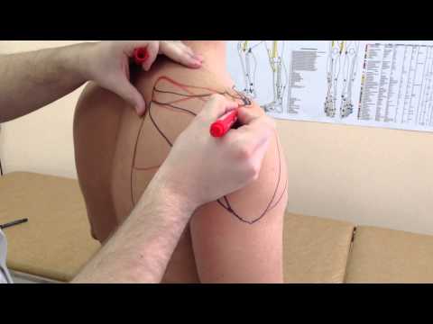 Плечевой сустав.Причины боли, лечение.4 часть.  The shoulder joint.Causes of pain treatment.part 4