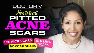 Dr V - How To Treat Pitted Acne Scars | Brown/ Black skin | Skin of colour | dehydrated skin