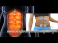 Placement et position electrode compex pour les abdominaux sur electrostimulateurch