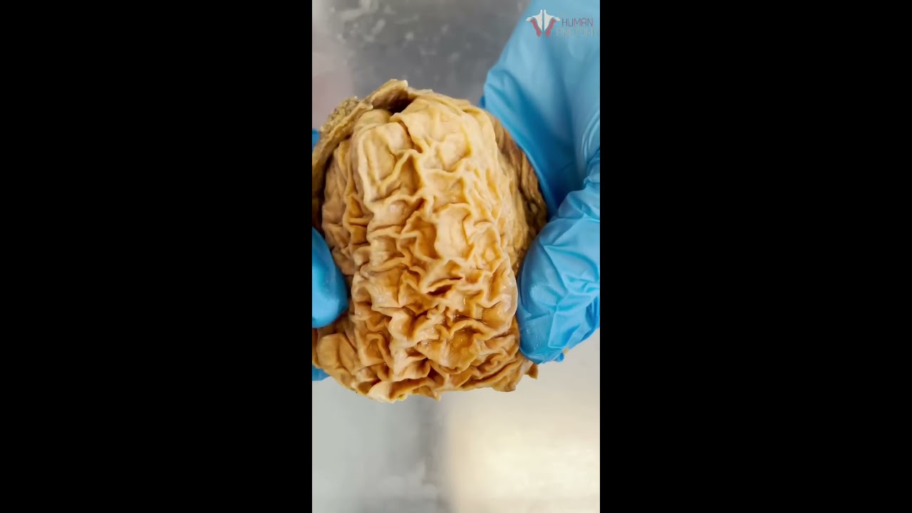 Looking Inside A Real Human Stomach Shorts Food