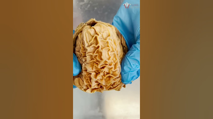 Looking Inside a Real Human Stomach | #shorts #food