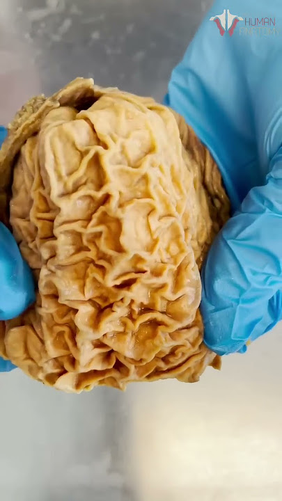 Looking Inside a Real Human Stomach | #shorts #food