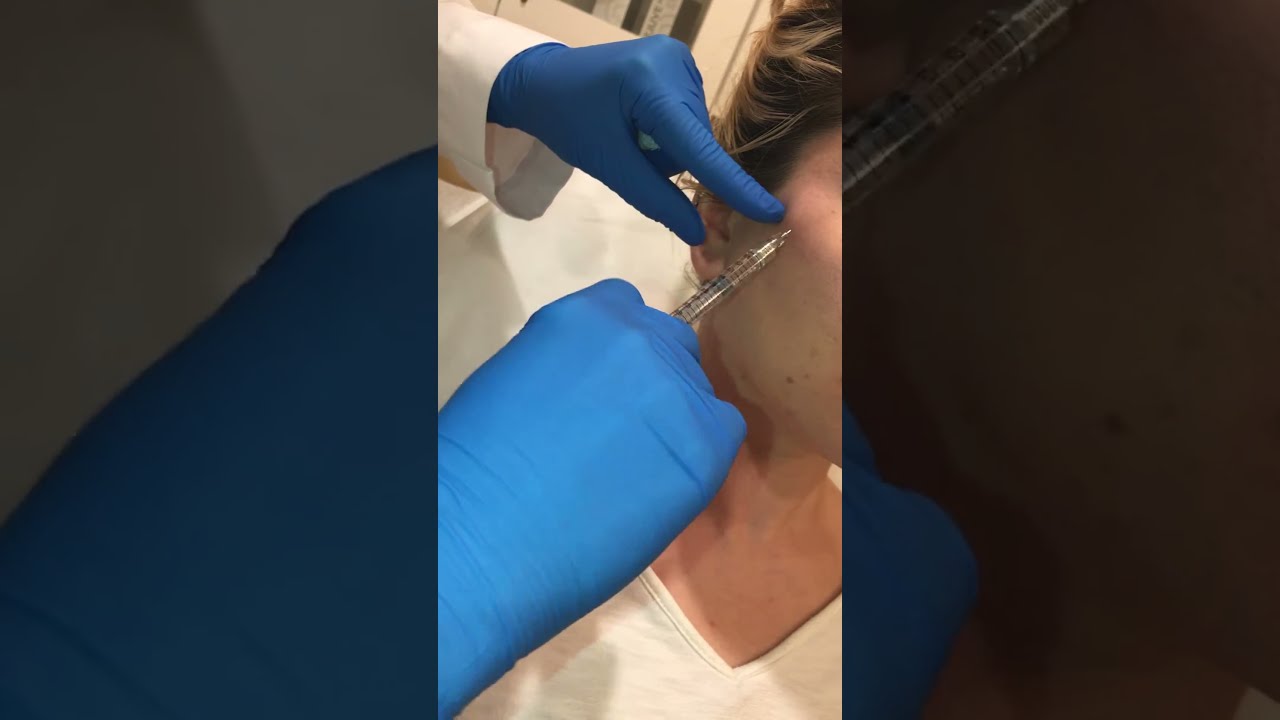 7Q Spa Laser Aesthetics Juvederm Voluma