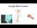 Benign Bone Tumors Made Simple