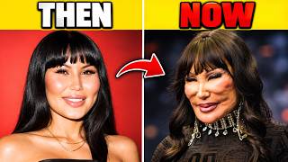 Details You Won’t Recognize These Stars After Their Plastic Surgery... Then and Now 2026! Guide