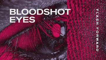 Flash Forward - Bloodshot Eyes (Official Video)