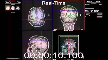 fMRI analysis in 15 seconds