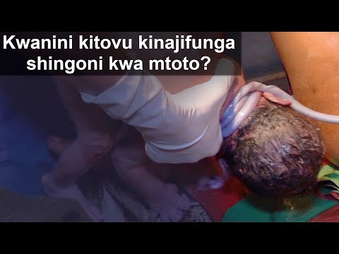 Video: Njia 4 za Kukata Kamba ya Umbilical ya Mtoto