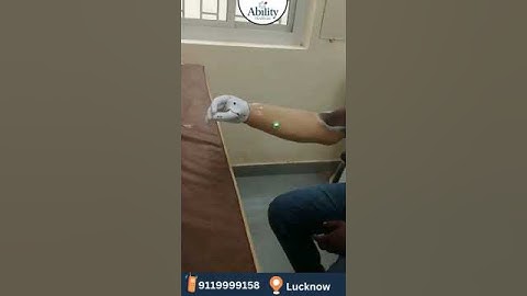 Most Advanced Bionic Hand in Lucknow #abilityhealthcare #bionichand #artificialhand #artificiallimb