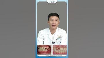 Răng Mọc Ngầm | Bác Sĩ Yên
