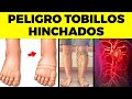 El DAÑO MORTAL Detrás de los TOBILLOS HINCHADOS Que Nadie Te Dice