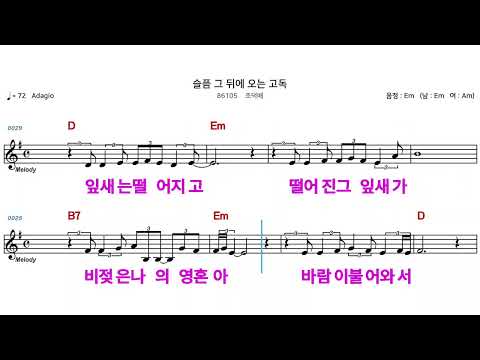 MR 86105 슬픔뒤에오는고독 조덕배