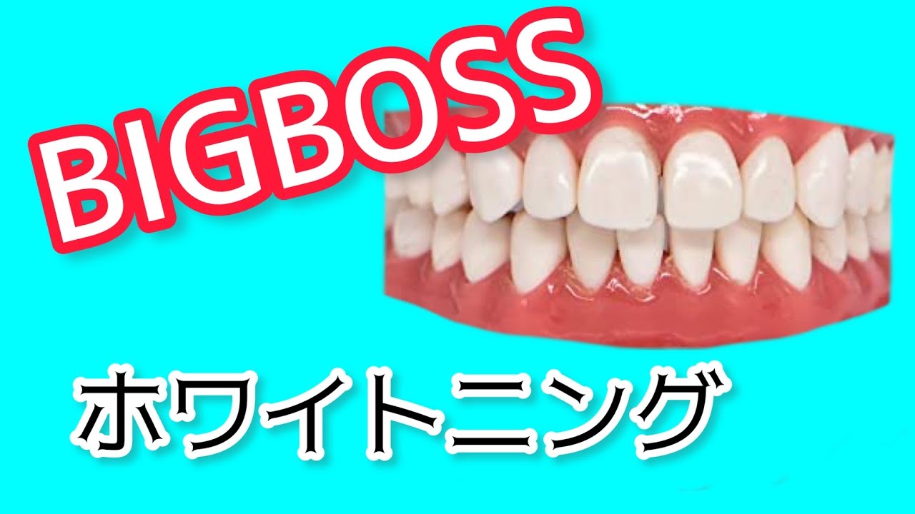 歯が白くなりたい！マー君改造