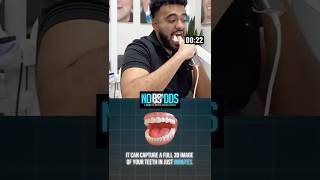 How Fast Can I Scan my Full Mouth #shorts