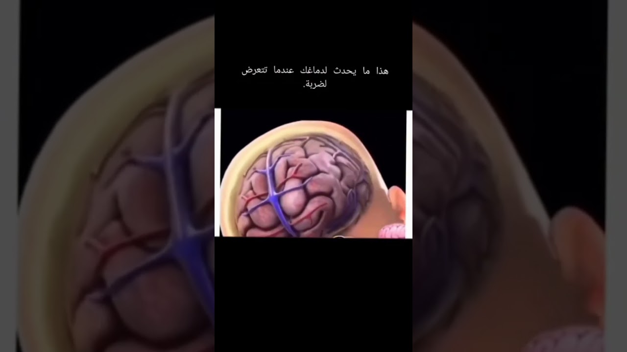 هذا ما يحدث لدماغك عندما تتعرض لضربة #اكسبلور #بيولوجي