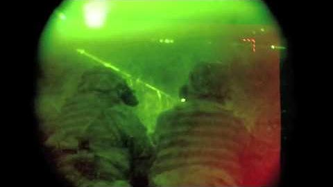 (21) Image Fusion Technology in Action