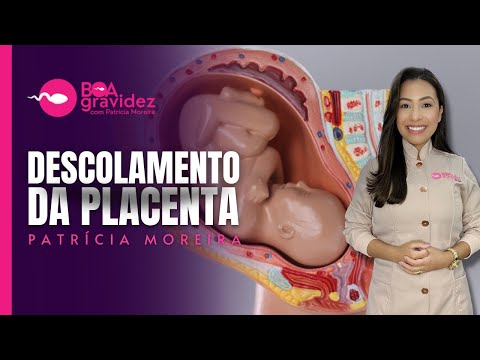 Vídeo: Como lidar com a placenta prévia (com fotos)