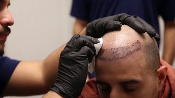 Hairline Ink Changes Client