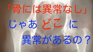 【腰痛 治し方】レントゲンで骨には異常なし。じゃあどこに異常があるの？