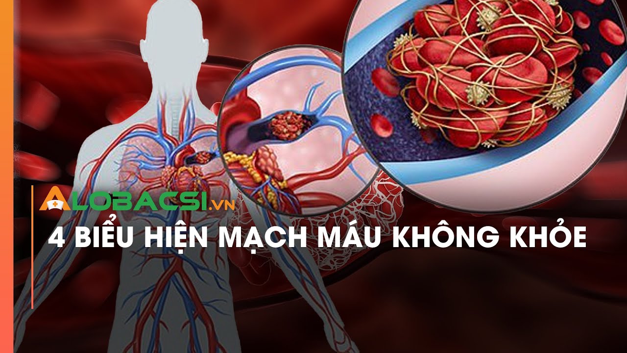 4 biểu hiện mạch máu không khỏe - YouTube
