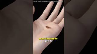 "Trigger Finger Release Surgery (3D Animation)#triggerfinger #triggerfingerrelease"