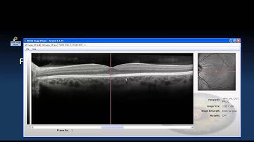 The DICOM Image Viewer