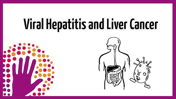Viral Hepatitis and Liver Cancer