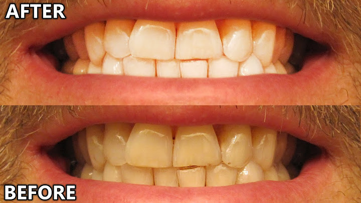 Which crest white strips are the strongest