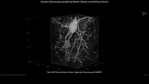 Striatal Thy1-GFP Neurons imaged by Aurora Light Sheet microscopy
