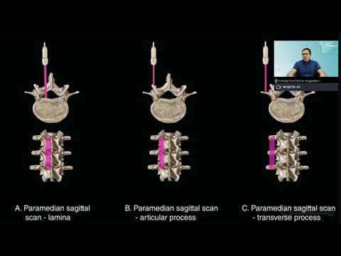Ультразвуковая диагностика позвоночника