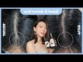 SHAMPO + TONIC UNTUK RAMBUT RONTOK  | 1 BULAN PERTAMA UDAH TUMBUH BANYAK