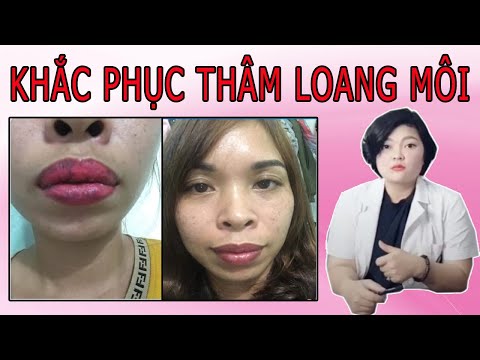 Nguyên Nhân Và Cách Khắc Phục Môi Bị Thâm Loang Sau Phun Xăm [ Trị Thâm Môi ]