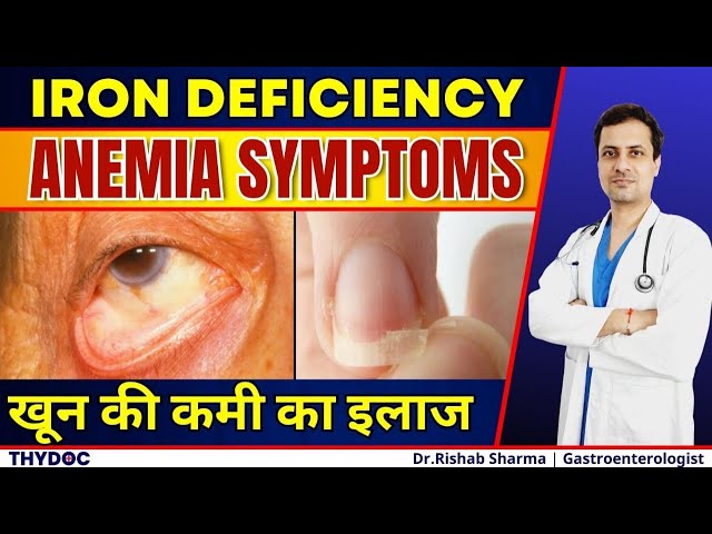 Anemia क्या है | Iron Deficiency Anemia Symptoms | शरीर में खून की कमी | एनीमिया के लक्षण