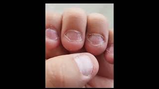 Como Fazer A Unha Crescer Rápido 💅🏼