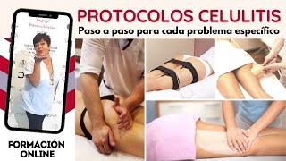 Cellulite Protocols: Step-by-step for each specific problem screenshot 3
