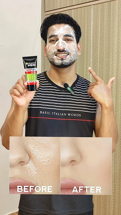 Garnier Men AcnoFight Face Wash | Best Anti-Pimple Face Wash for Men 😎✨ #shorts
