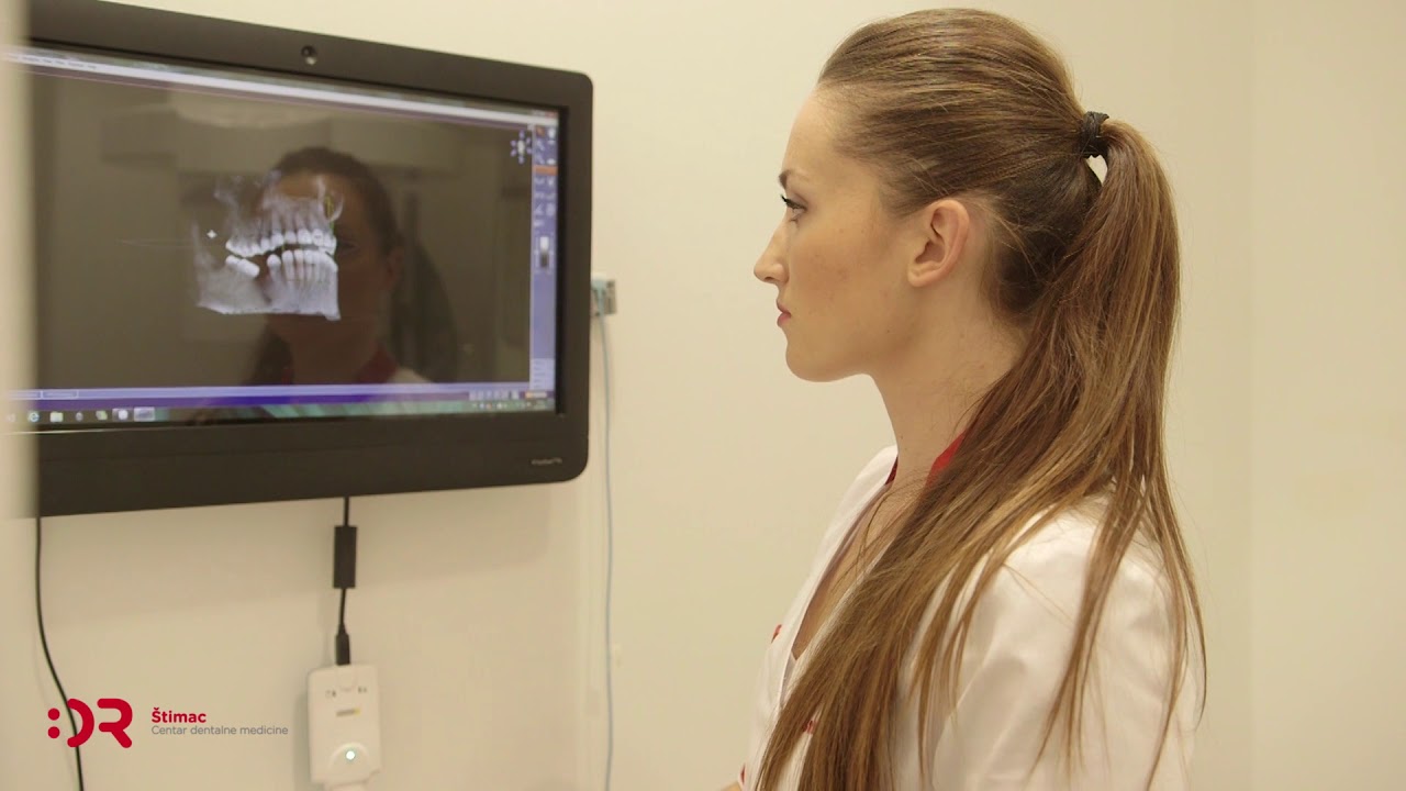 La panoramica dentale