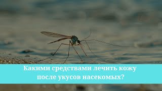 Какими средствами лечить кожу после укусов насекомых?