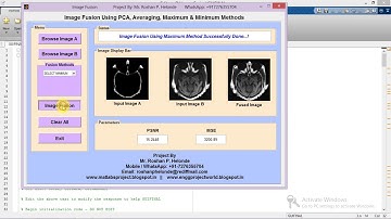 Matlab Code for Image Fusion Using PCA on MRI and CT Image