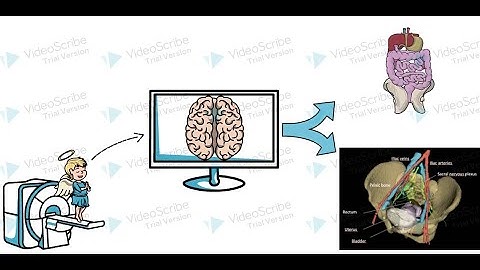 My PhD Thesis in 180 seconds - 3D reconstruction from Child