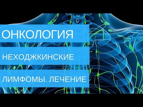 НЕХОДЖКИНСКИЕ ЛИМФОМЫ лечение 1, 2, 3, 4 стадий