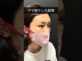 【クマ取り】ビフォーアフター|美容医療