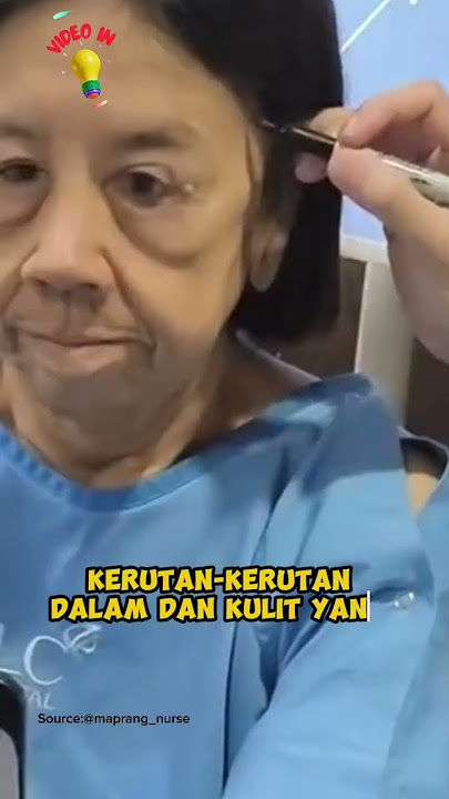Perempuan Ini Mengejutkan Semua Orang dengan Transformasi Muda Pasca Operasi Plastik!