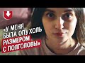 Не может глотать и живет с гастростомой: Лера | Быть молодым