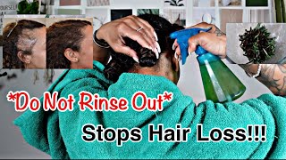 DO NOT RINSE THIS OUT & YOUR HAIR WILL NEVER STOP GROWING *STOPS HAIR LOSS & BALDING *