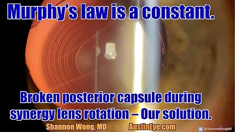 Murphy’s law is a constant.  Broken posterior capsule during Synergy lens rotation – Our solution.