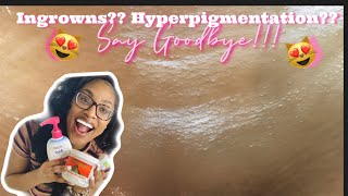 DIY VAJACIAL AT HOME! 100% INGROWNS AND HYPERPIGMENTATION FREE!!!! | Jalia Naki