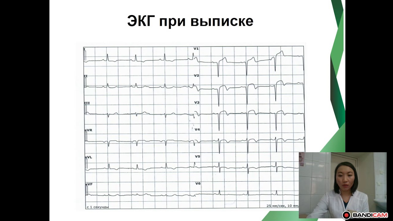 Мандалуева М.Г. Вторичная профилактика после перенесенного инфаркта миокарда