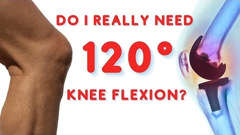 Do You Really Need 120° Of Knee Flexion (Bending)? Total Knee Replacement